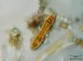 Cymatopleura solea